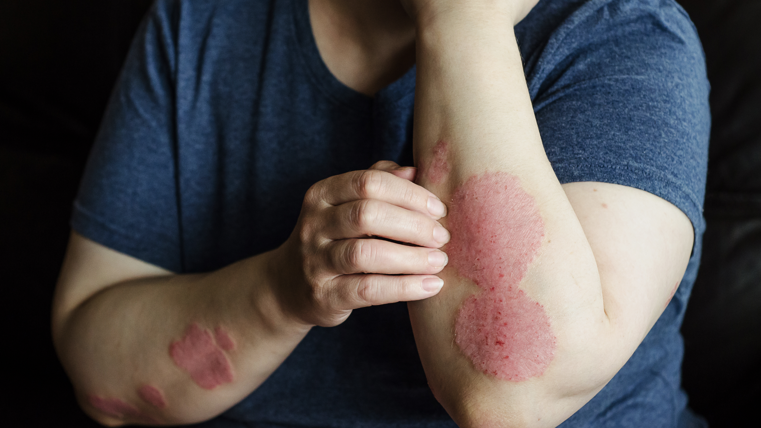 Skin & Allergy Care